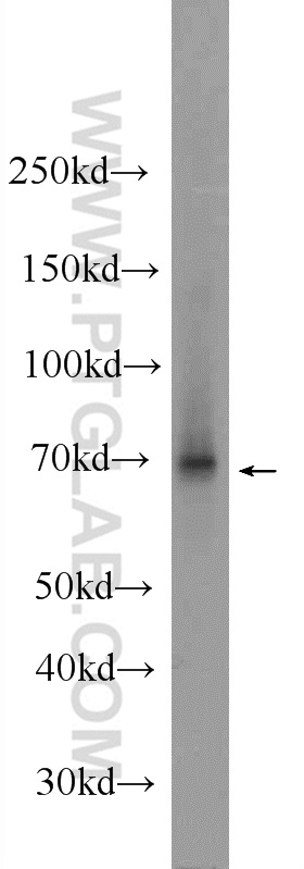 TAF15 Polyclonal antibody