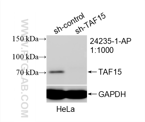 WB analysis of HeLa using 24235-1-AP
