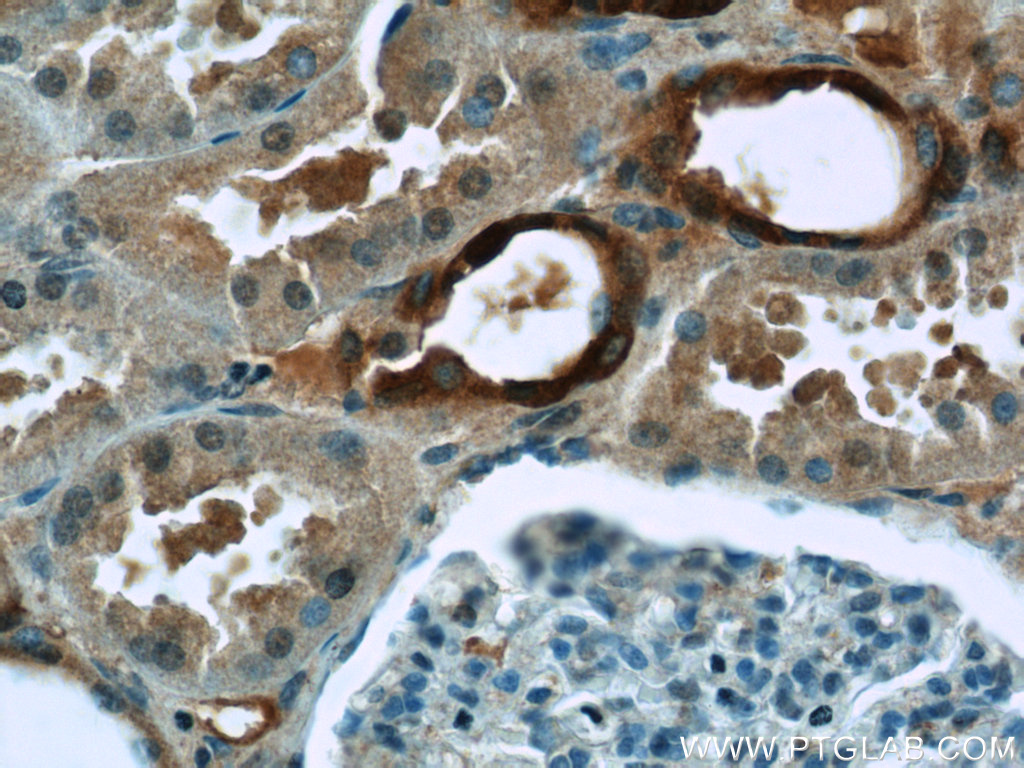 IHC staining of human kidney using 25521-1-AP