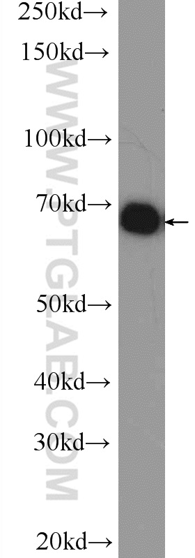 WB analysis of Jurkat using 25521-1-AP
