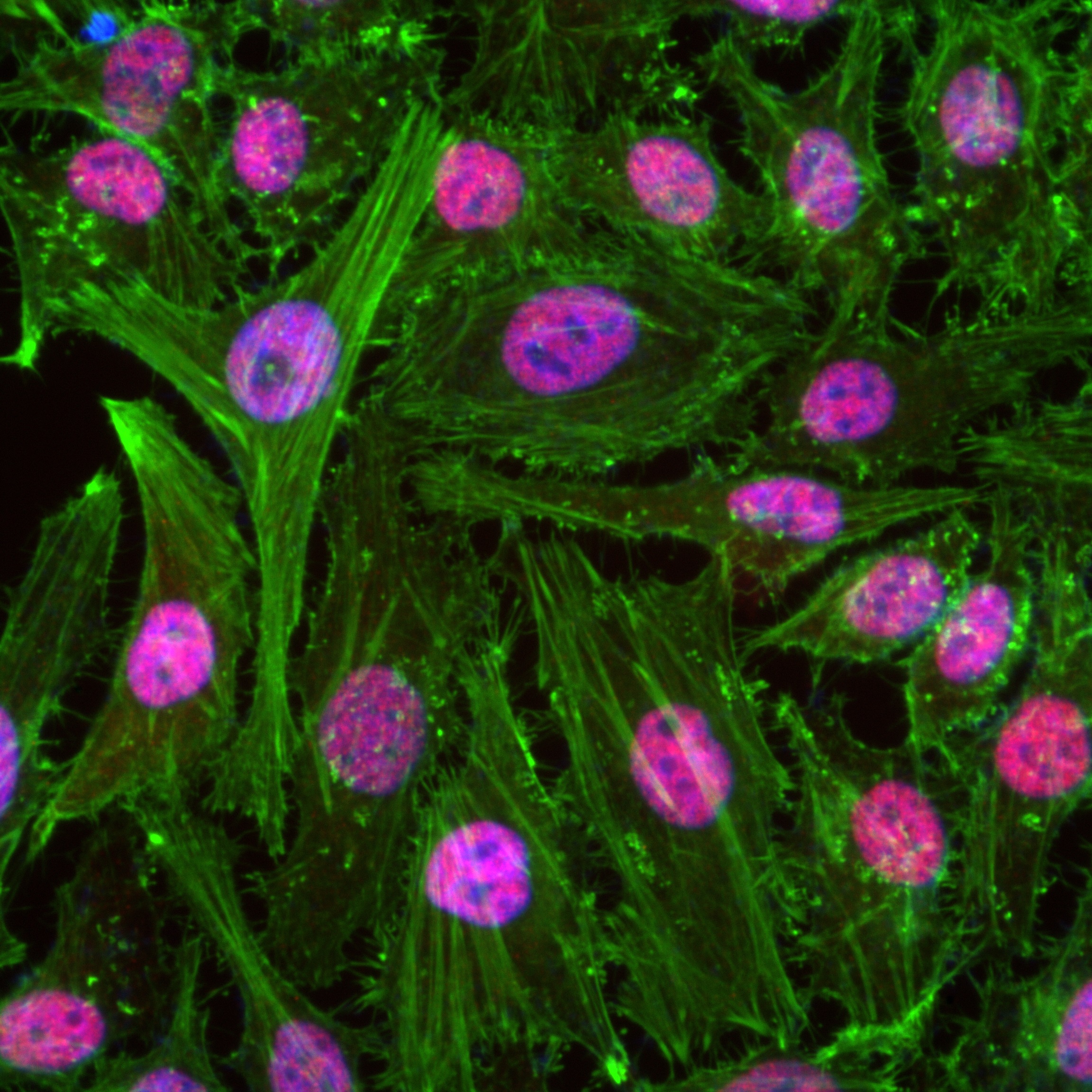 IF Staining of HeLa using 82860-1-RR (same clone as 82860-1-PBS)