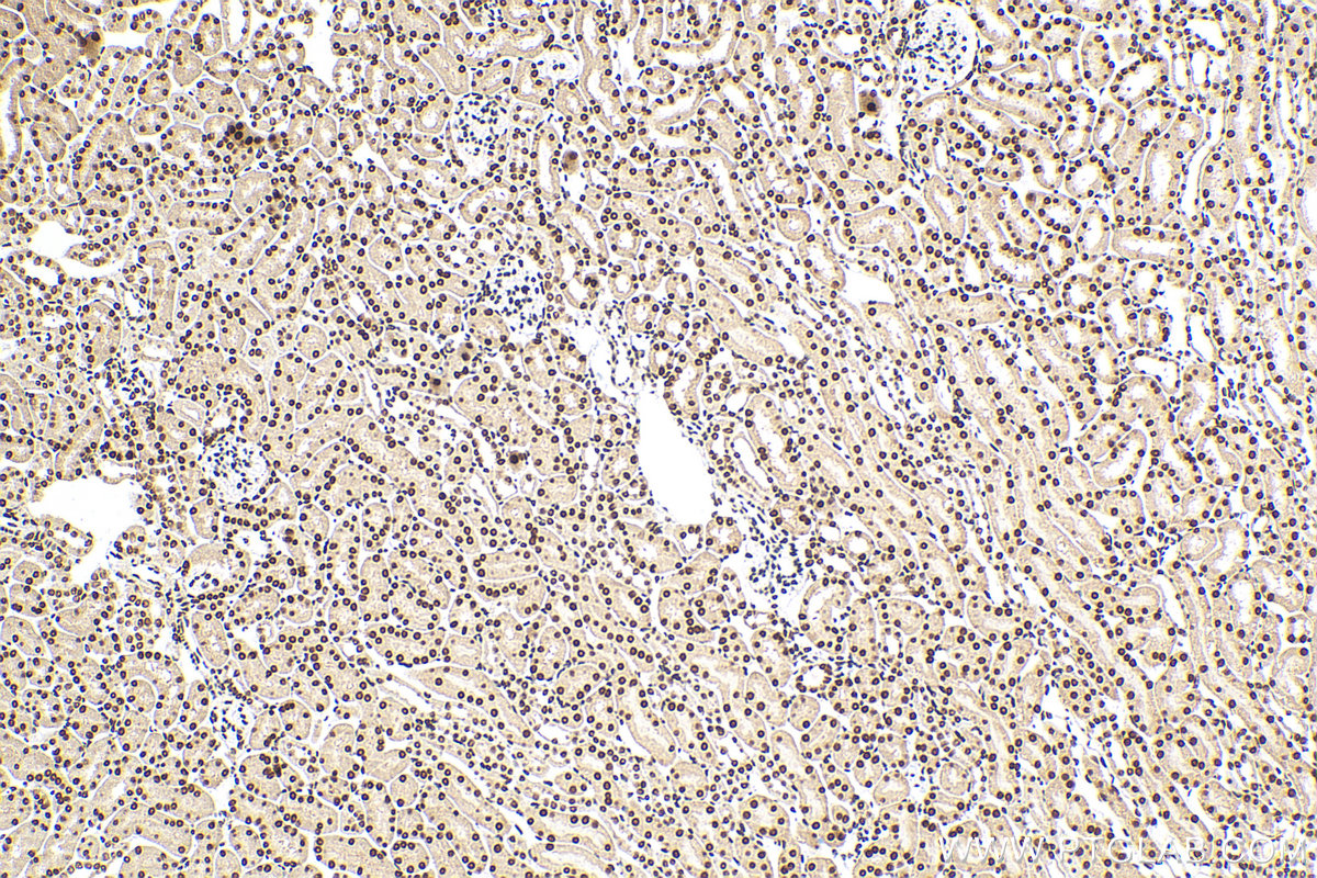 IHC staining of mouse kidney using 82860-1-RR (same clone as 82860-1-PBS) IHC staining of mouse kidney using 82860-1-RR (same clone as 82860-1-PBS)