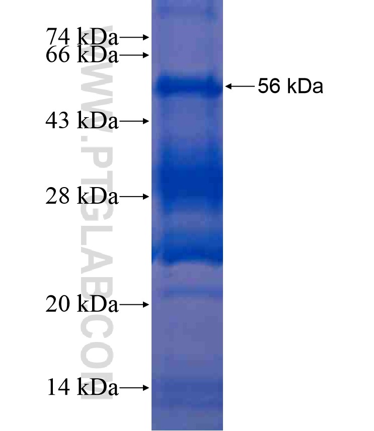 TAF15 fusion protein Ag17805 SDS-PAGE TAF15 fusion protein Ag17805 SDS-PAGE