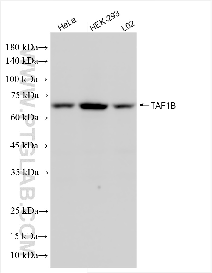 WB analysis of HeLa using 85885-4-RR (same clone as 85885-4-PBS)