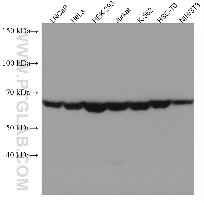 WB analysis using 67569-1-Ig (same clone as 67569-1-PBS)