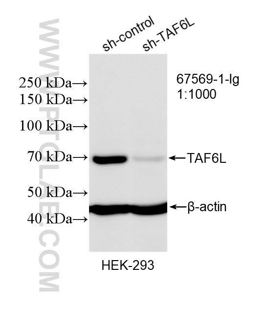 WB result of TAF6L antibody (67569-1-Ig; 1:1000; incubated at room temperature for 1.5 hours) with sh-Control and sh-TAF6L transfected HEK-293 cells. WB analysis of HEK-293 using 67569-1-Ig