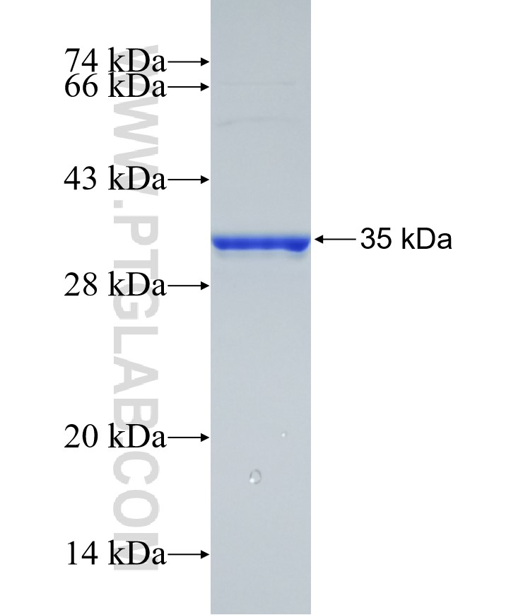 TAF9B fusion protein Ag29615 SDS-PAGE