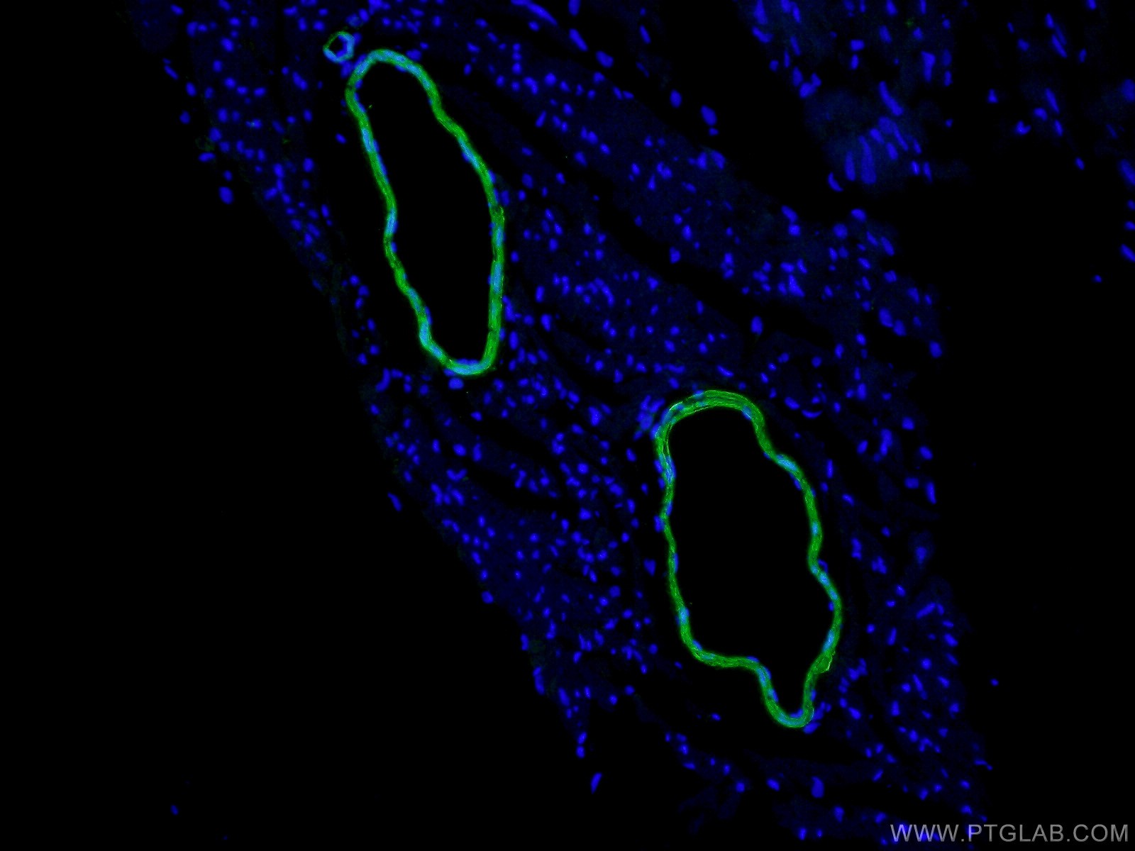 IF Staining of mouse heart using 10493-1-AP