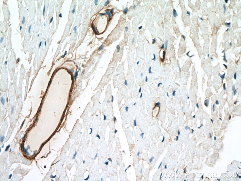 IHC staining of mouse heart using 10493-1-AP