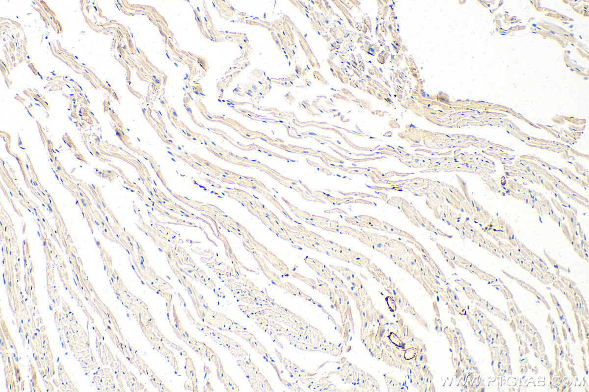 Immunohistochemical analysis of paraffin-embedded mouse heart tissue slide using 10493-1-AP (transgelin/SM22 antibody) at dilution of 1:2000 (under 10x lens). Heat mediated antigen retrieval with Tris-EDTA buffer (pH 9.0). IHC staining of mouse heart using 10493-1-AP