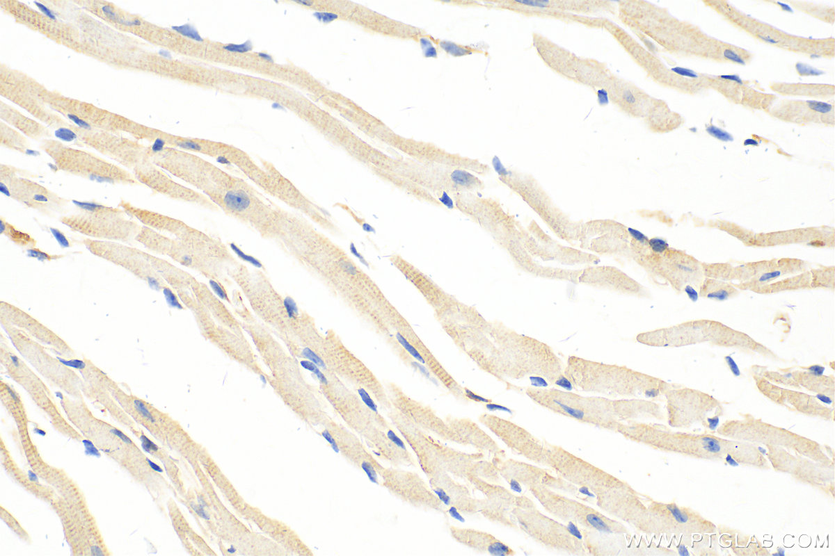 Immunohistochemical analysis of paraffin-embedded mouse heart tissue slide using 10493-1-AP (transgelin/SM22 antibody) at dilution of 1:2000 (under 40x lens). Heat mediated antigen retrieval with Tris-EDTA buffer (pH 9.0). IHC staining of mouse heart using 10493-1-AP
