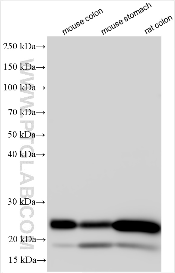 WB analysis using 10493-1-AP