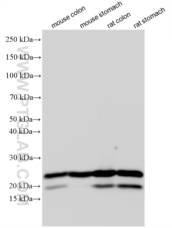 Various lysates were subjected to SDS PAGE followed by western blot with 10493-1-AP (transgelin/SM22 antibody) at dilution of 1:50000 incubated at room temperature for 1.5 hours. WB analysis using 10493-1-AP
