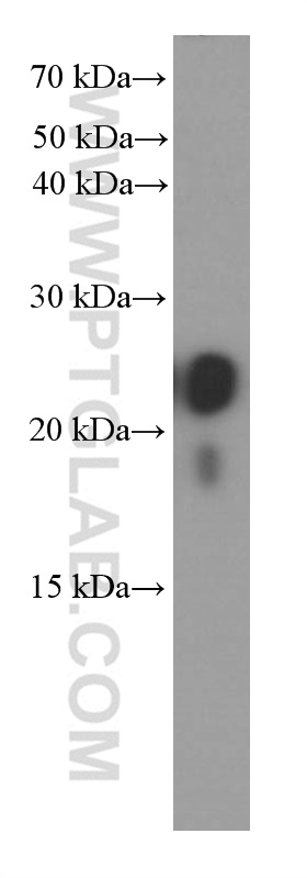 WB analysis of human colon using 60213-1-Ig