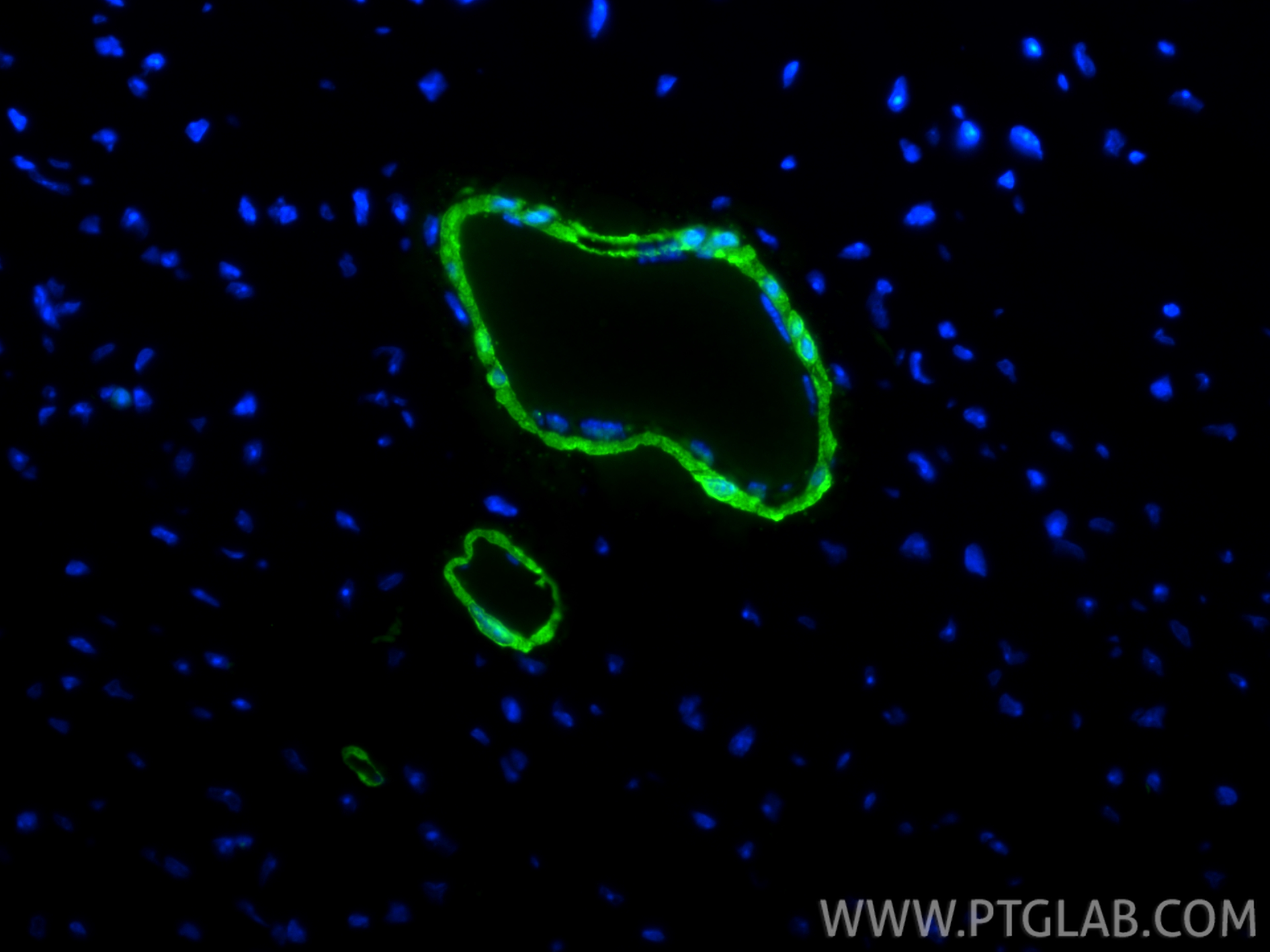 IF Staining of mouse heart using RMX00045