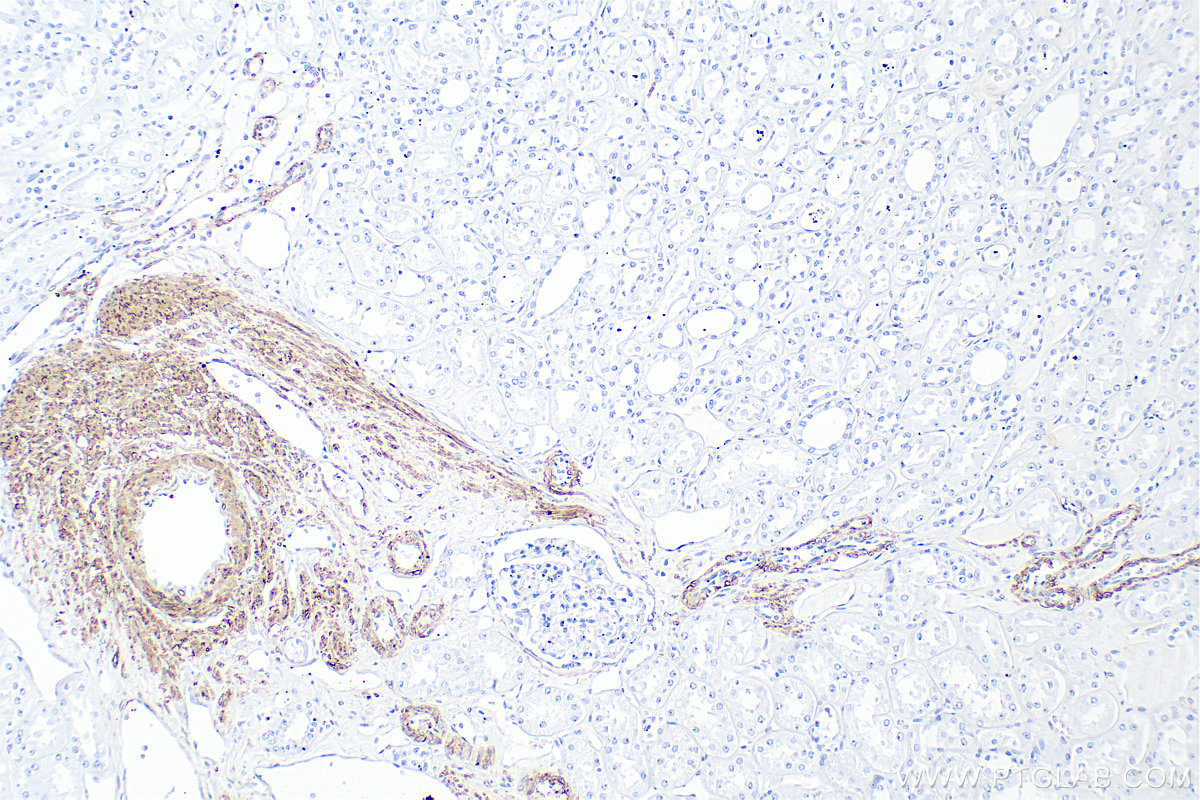 IHC staining of human kidney using RMX00045