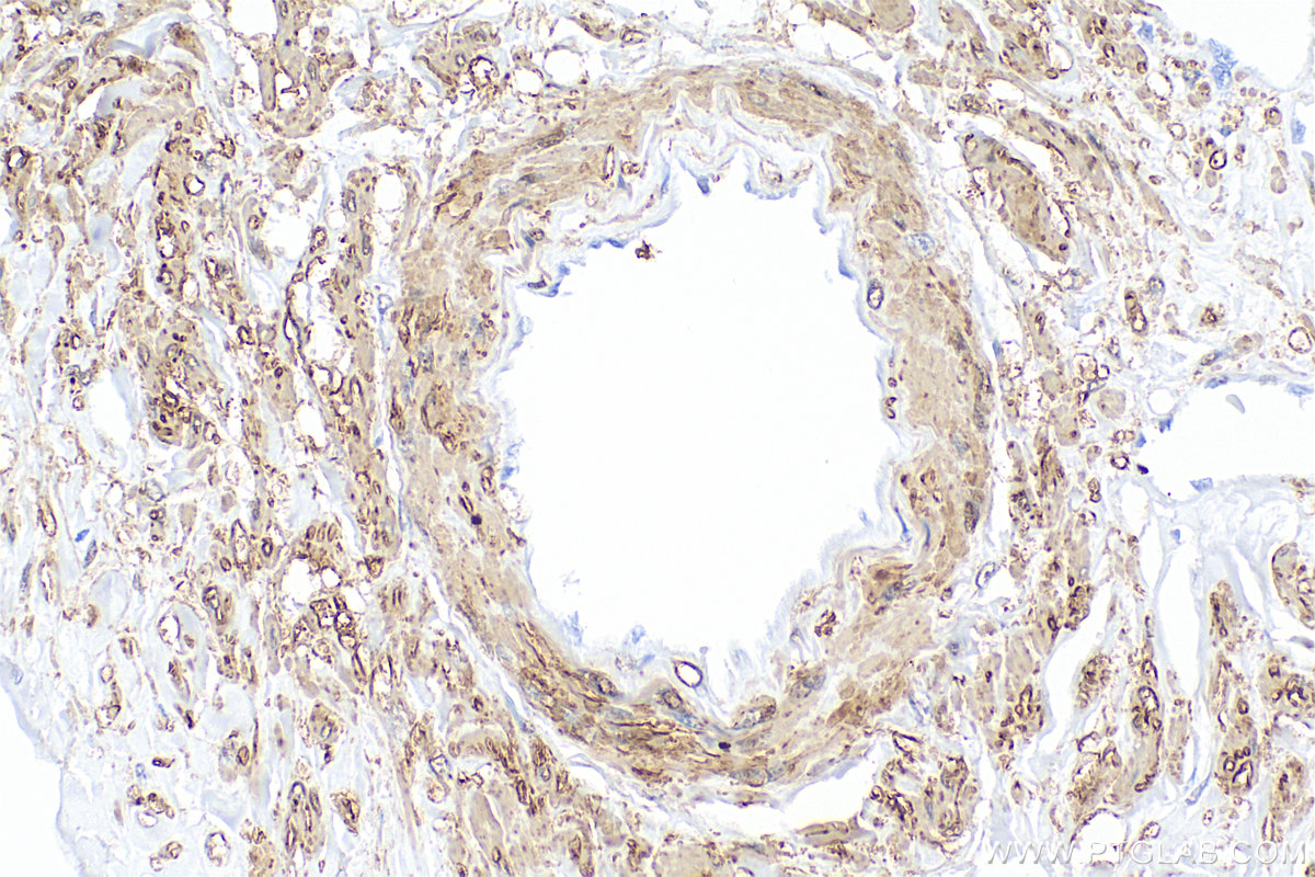 IHC staining of human kidney using RMX00045