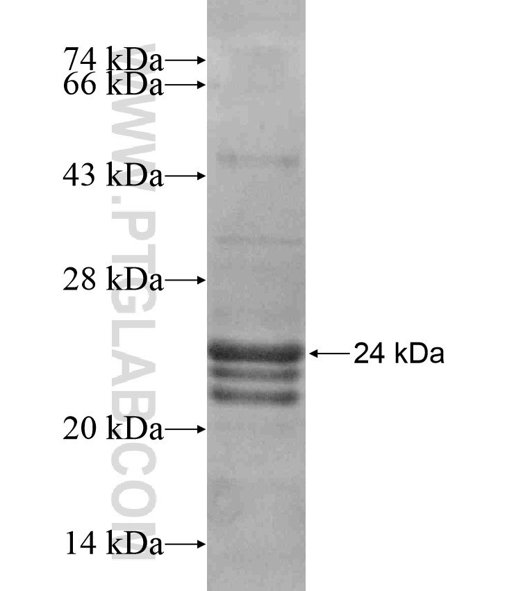 TAGLN fusion protein Ag18031 SDS-PAGE TAGLN fusion protein Ag18031 SDS-PAGE