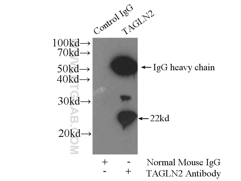 IP experiment of HEK-293 using 60044-1-Ig