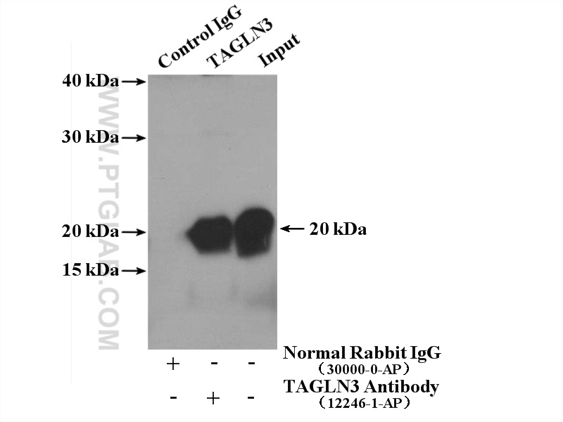 IP experiment of mouse brain using 12246-1-AP