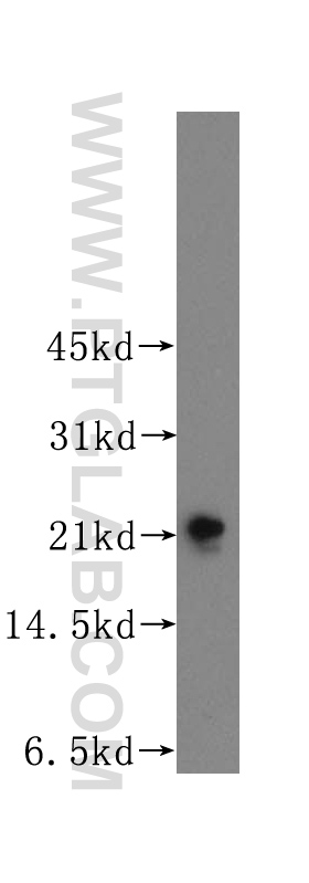 WB analysis of mouse brain using 12246-1-AP