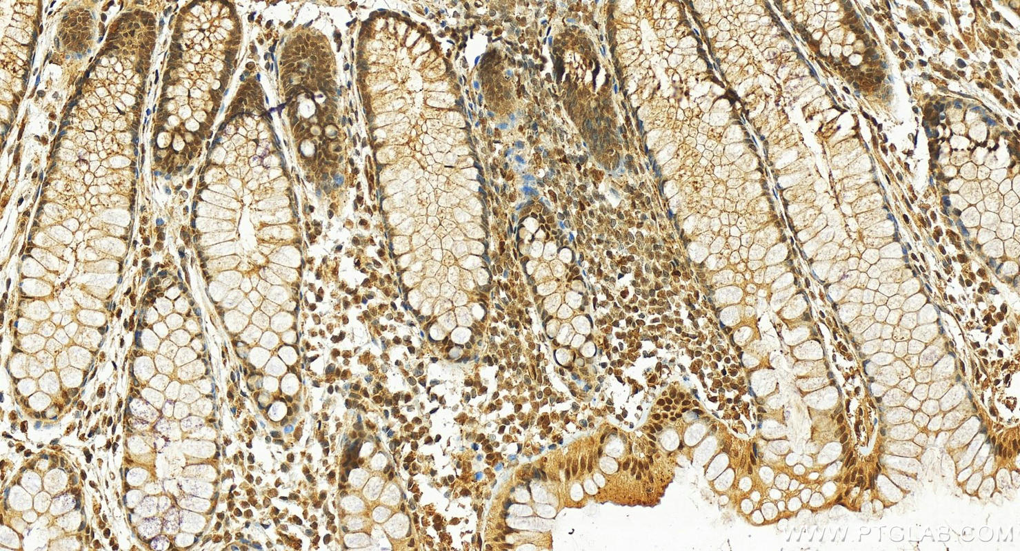 IHC staining of human colon using 12376-1-AP