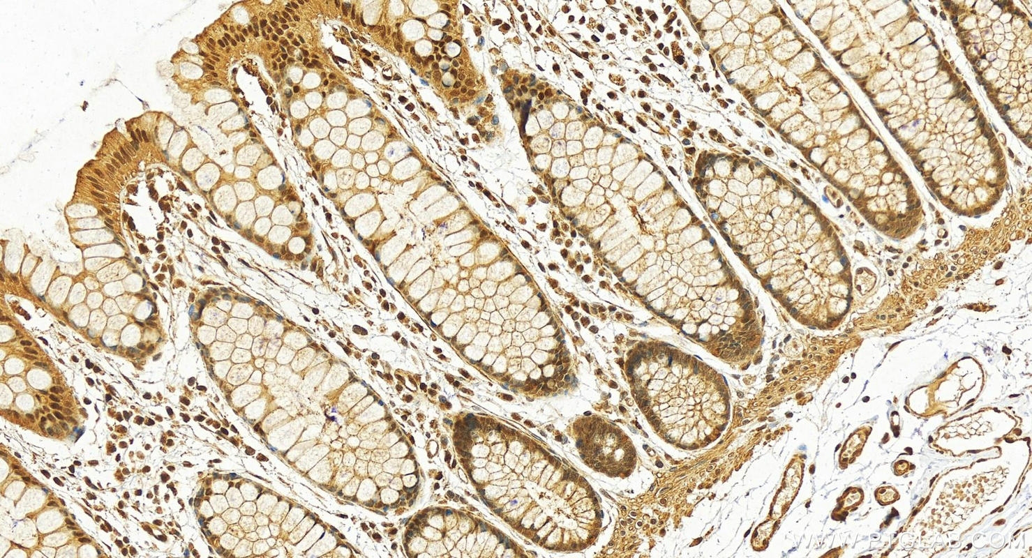 IHC staining of human colon using 12376-1-AP