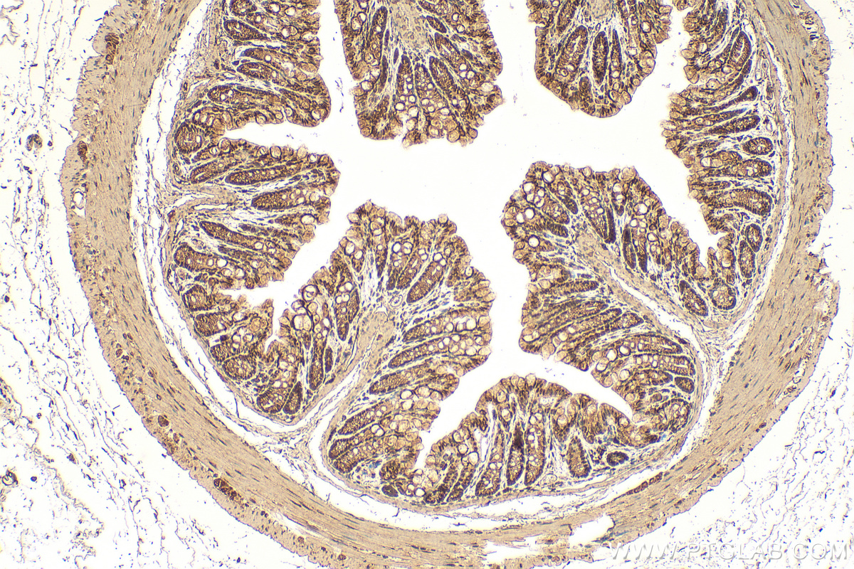 Immunohistochemical analysis of paraffin-embedded mouse colon tissue slide using 12376-1-AP (TALDO1 antibody) at dilution of 1:200 (under 10x lens). Heat mediated antigen retrieval with Tris-EDTA buffer (pH 9.0). IHC staining of mouse colon using 12376-1-AP