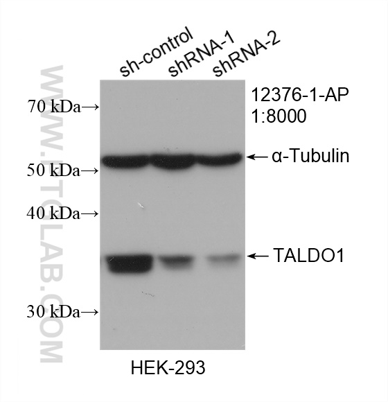 WB analysis of HEK-293 using 12376-1-AP