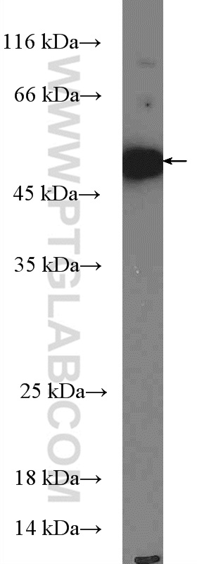 WB analysis of THP-1 using 27065-1-AP