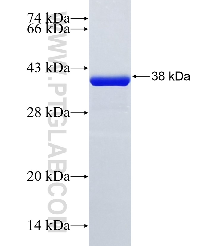 TANK fusion protein Ag25740 SDS-PAGE