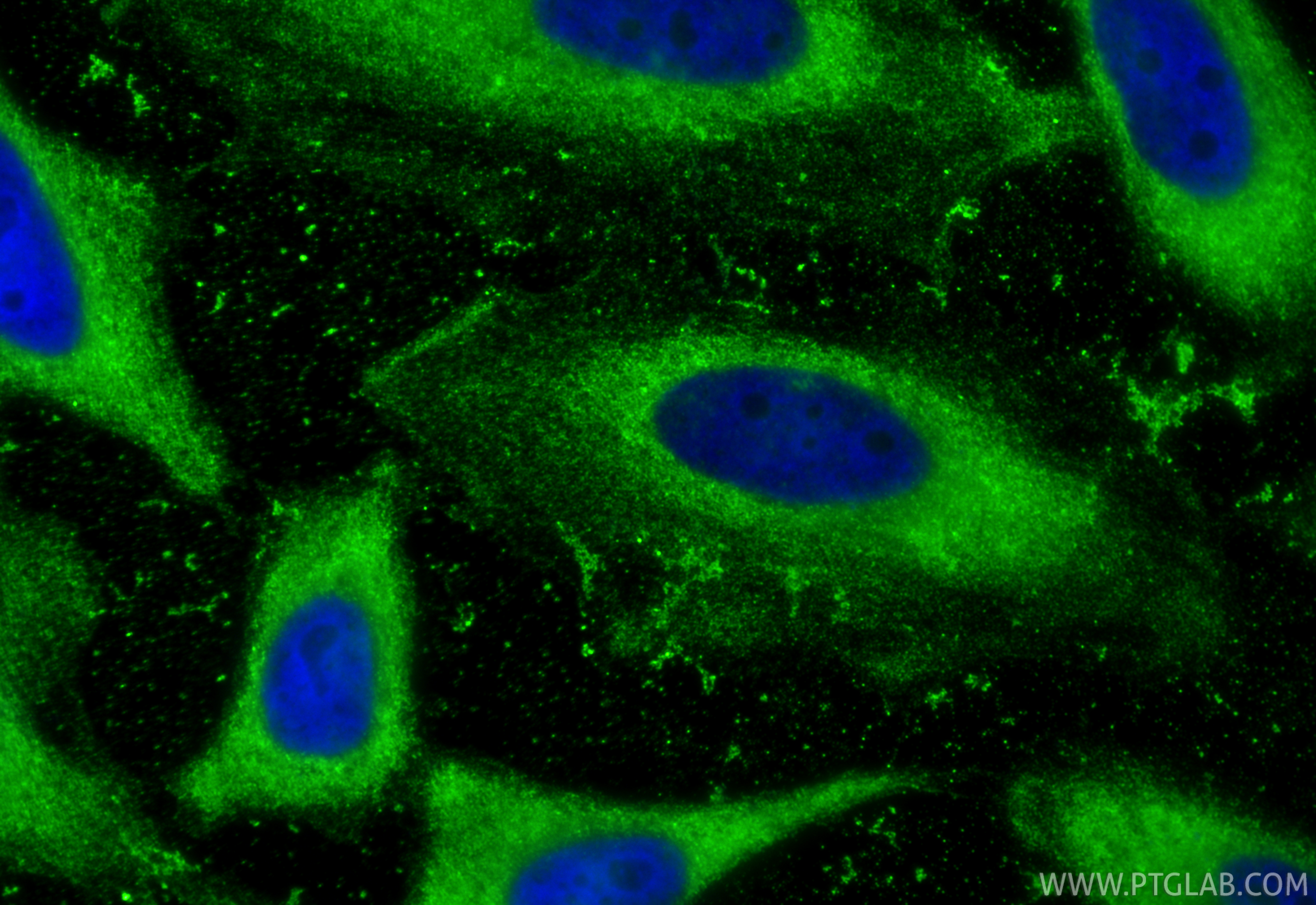 IF Staining of HeLa using 67451-1-Ig (same clone as 67451-1-PBS)