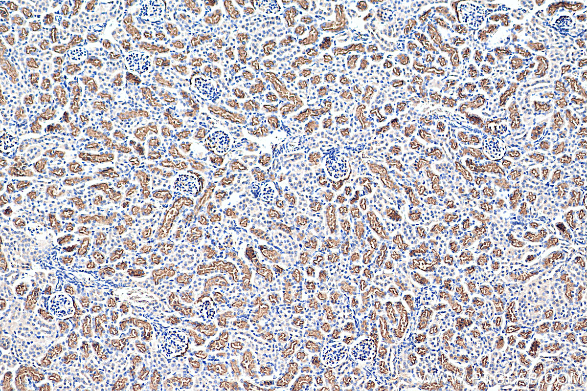 IHC staining of mouse kidney using 67451-1-Ig