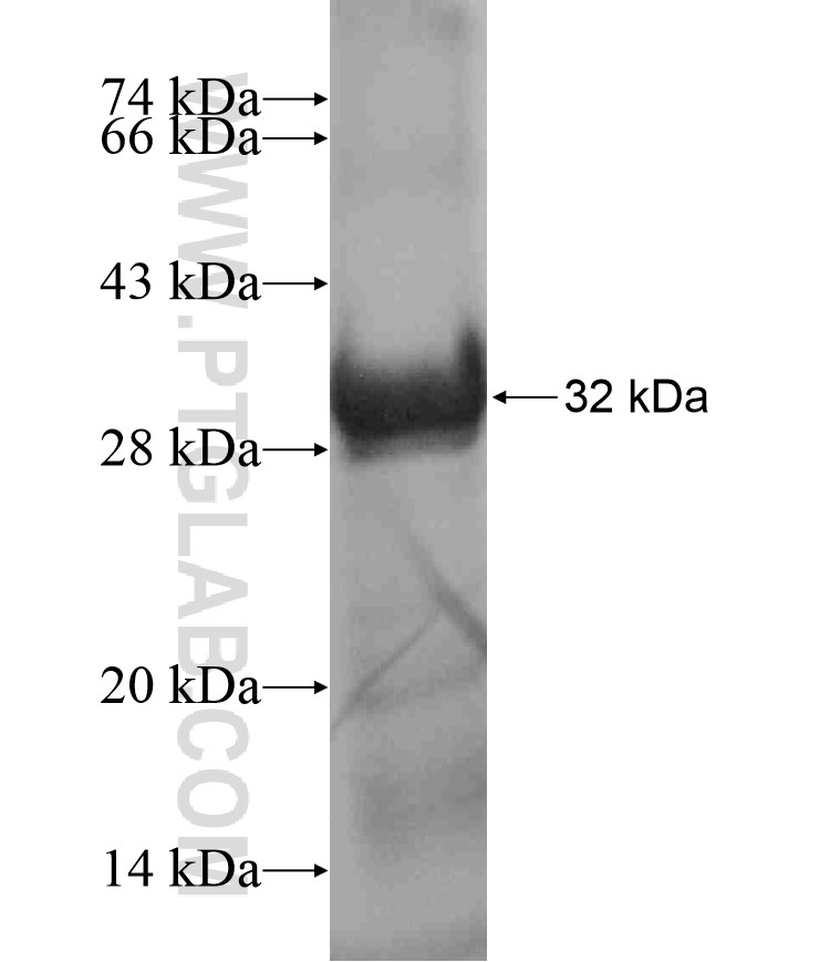 TAOK3 fusion protein Ag17869 SDS-PAGE TAOK3 fusion protein Ag17869 SDS-PAGE