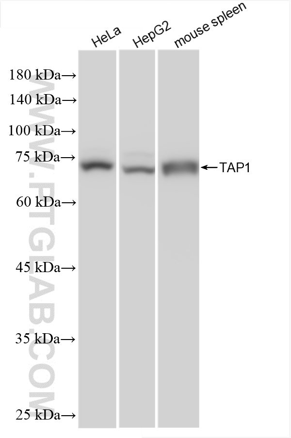 WB analysis using 85766-4-RR (same clone as 85766-4-PBS)