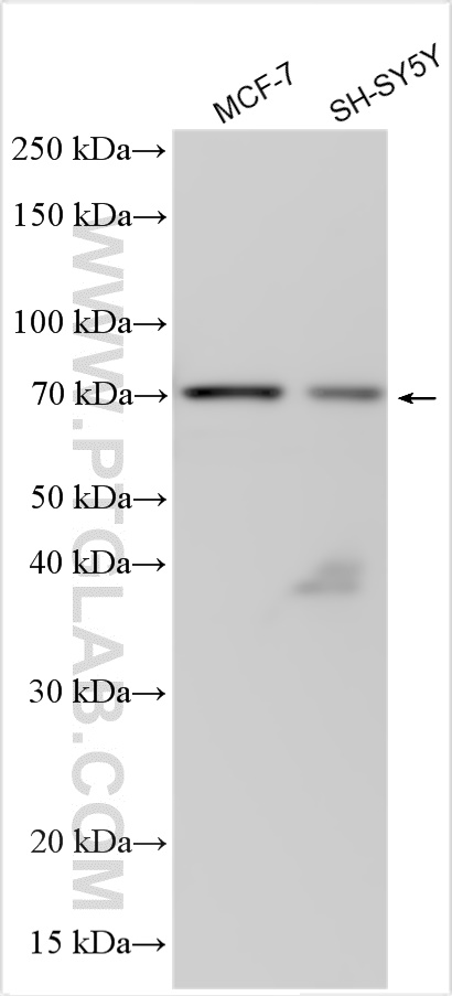 WB analysis using 10161-1-AP