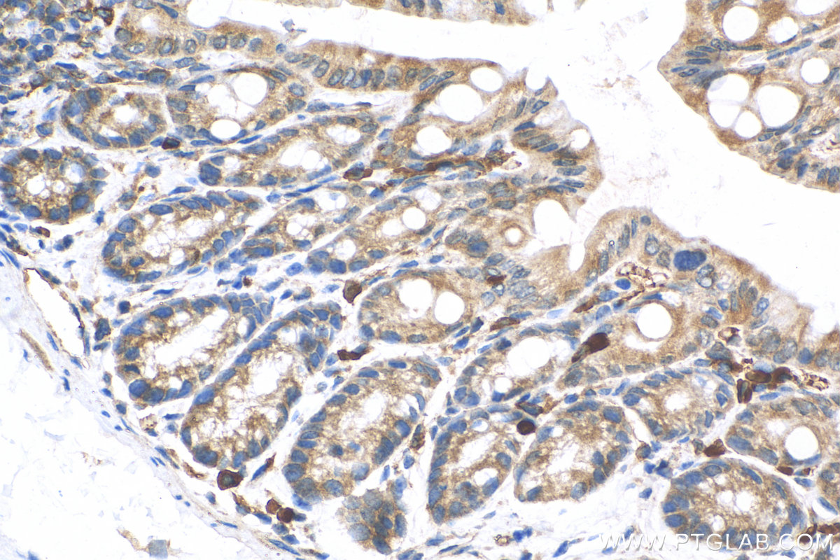 IHC staining of mouse colon using 30500-1-AP