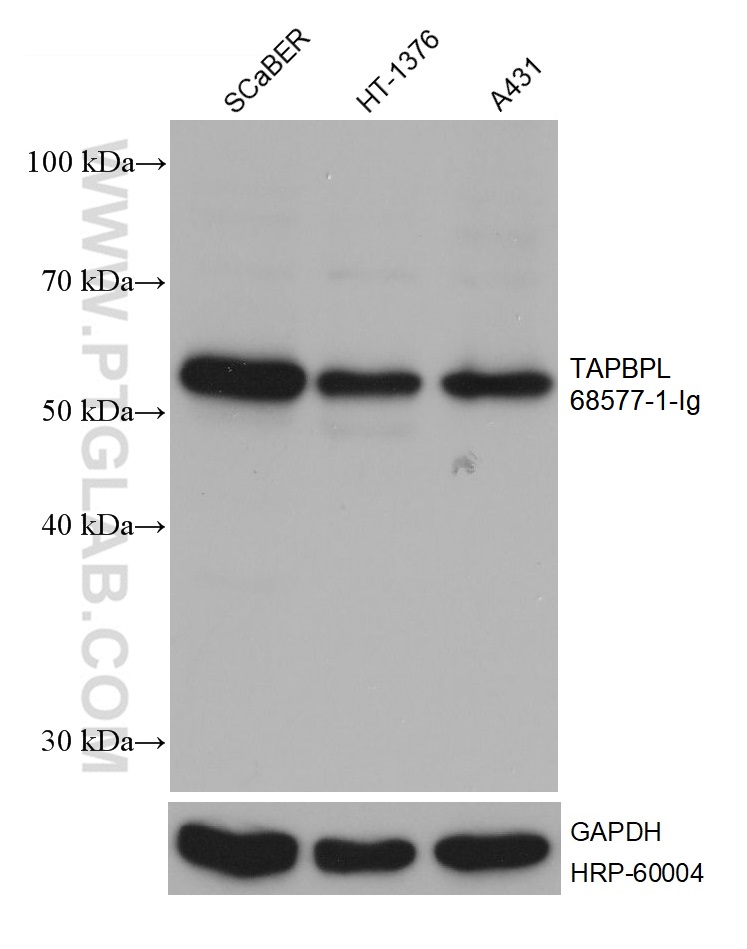 WB analysis using 68577-1-Ig