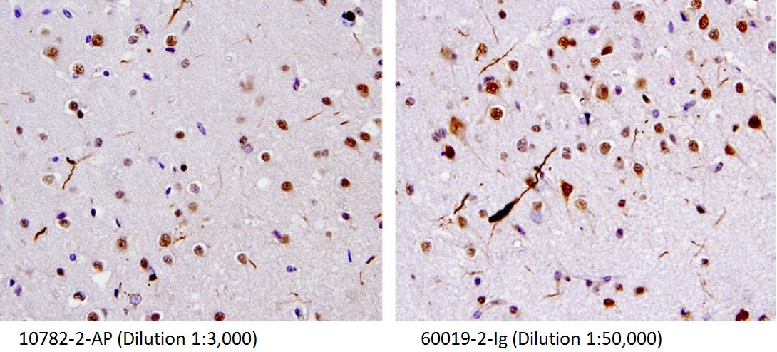 IHC staining of human brain (FTLD-U) tissue using 10782-2-AP