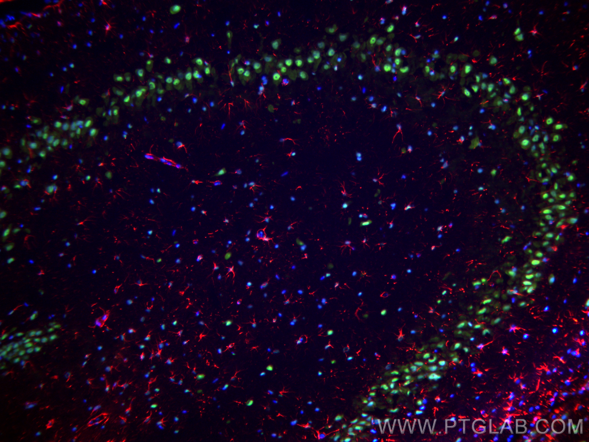 IF Staining of rat brain using 10782-2-AP