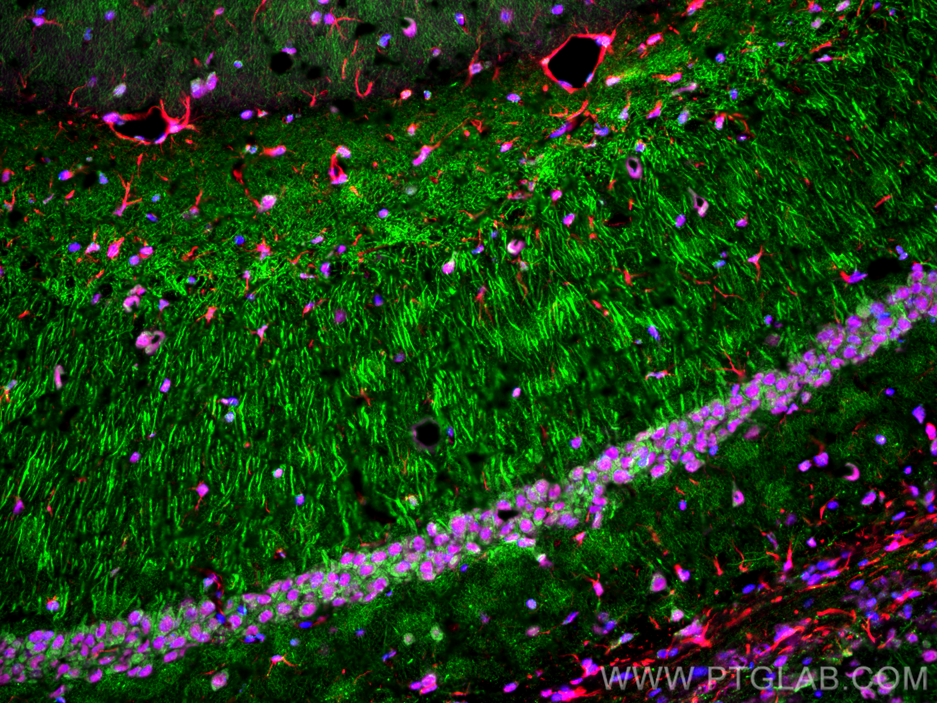 IF Staining of mouse brain using 10782-2-AP