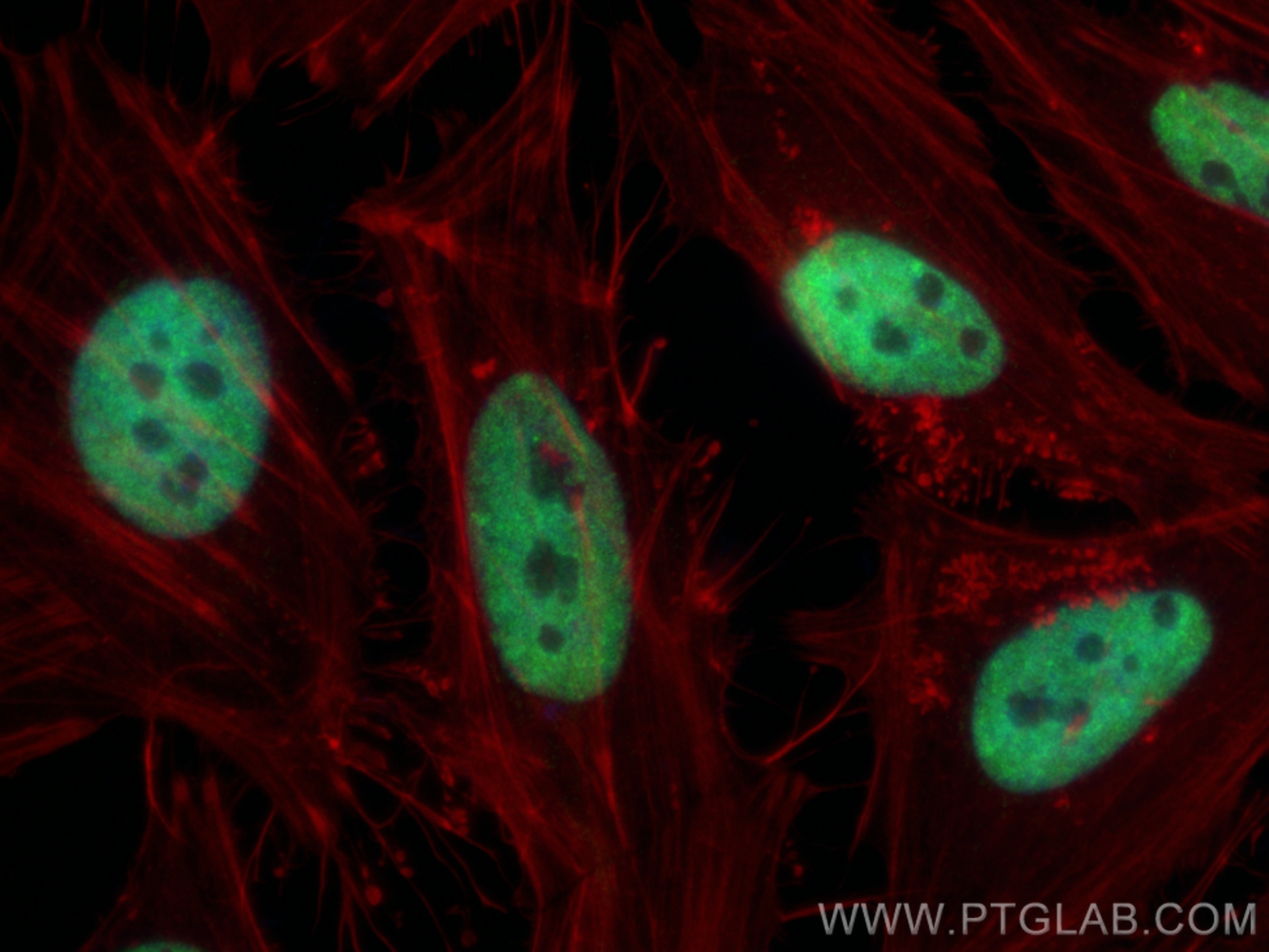 IF Staining of HeLa using 12892-1-AP