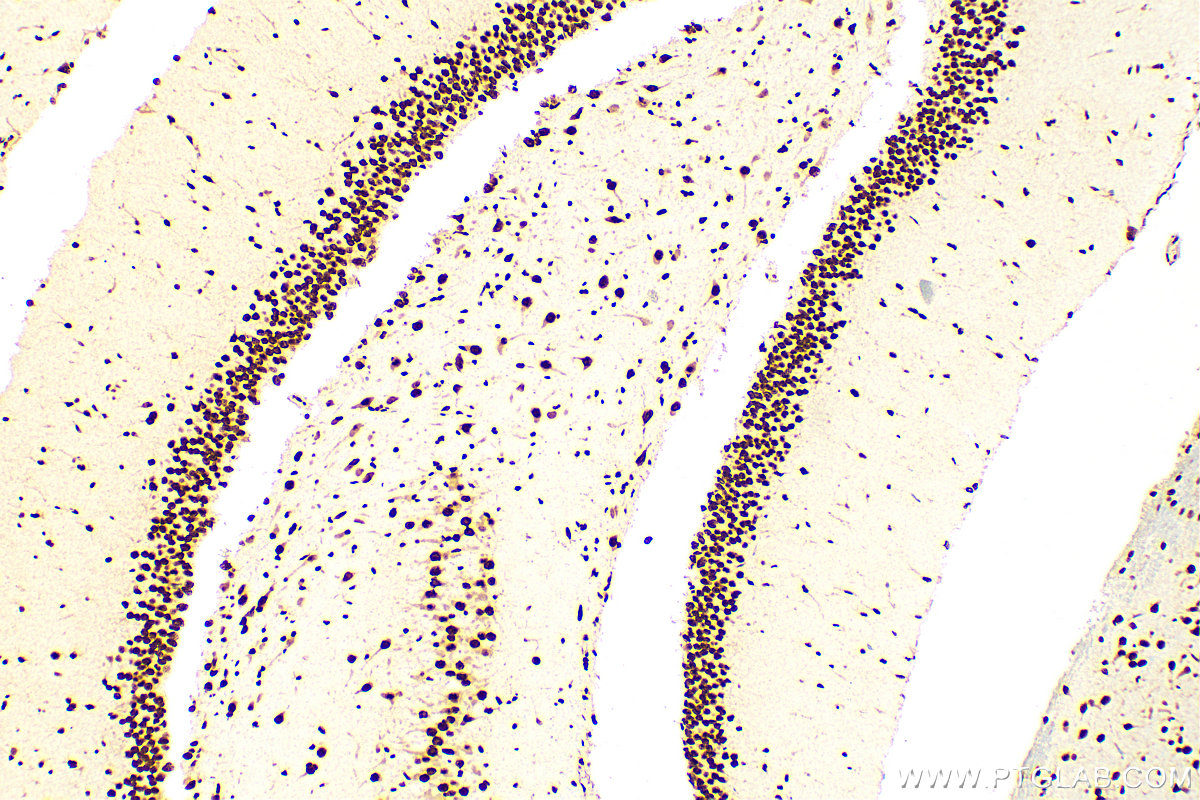 IHC staining of rat brain using 12892-1-AP