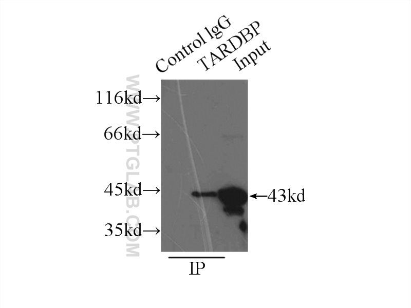 IP experiment of HeLa using 12892-1-AP