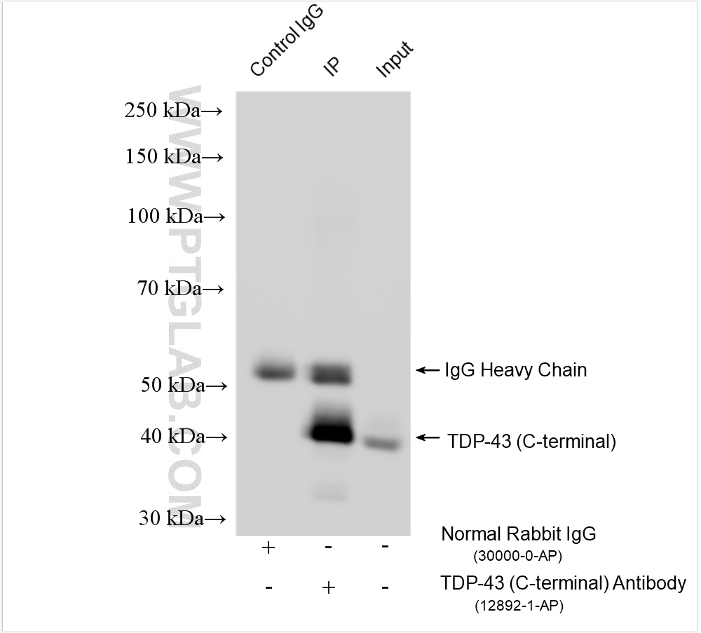 IP experiment of mouse brain using 12892-1-AP