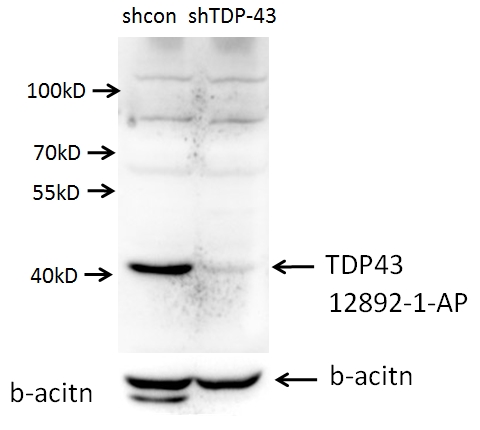 WB analysis of A549 cells using 12892-1-AP