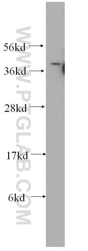 WB analysis of human brain using 60019-1-Ig