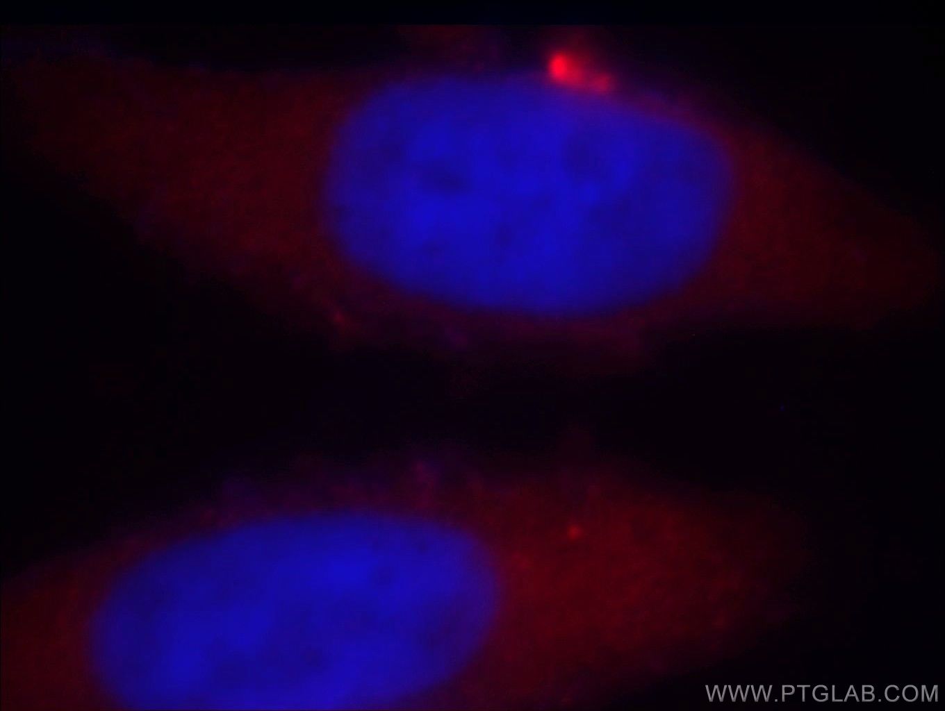 IF Staining of MCF-7 using 14773-1-AP (same clone as 14773-1-PBS)