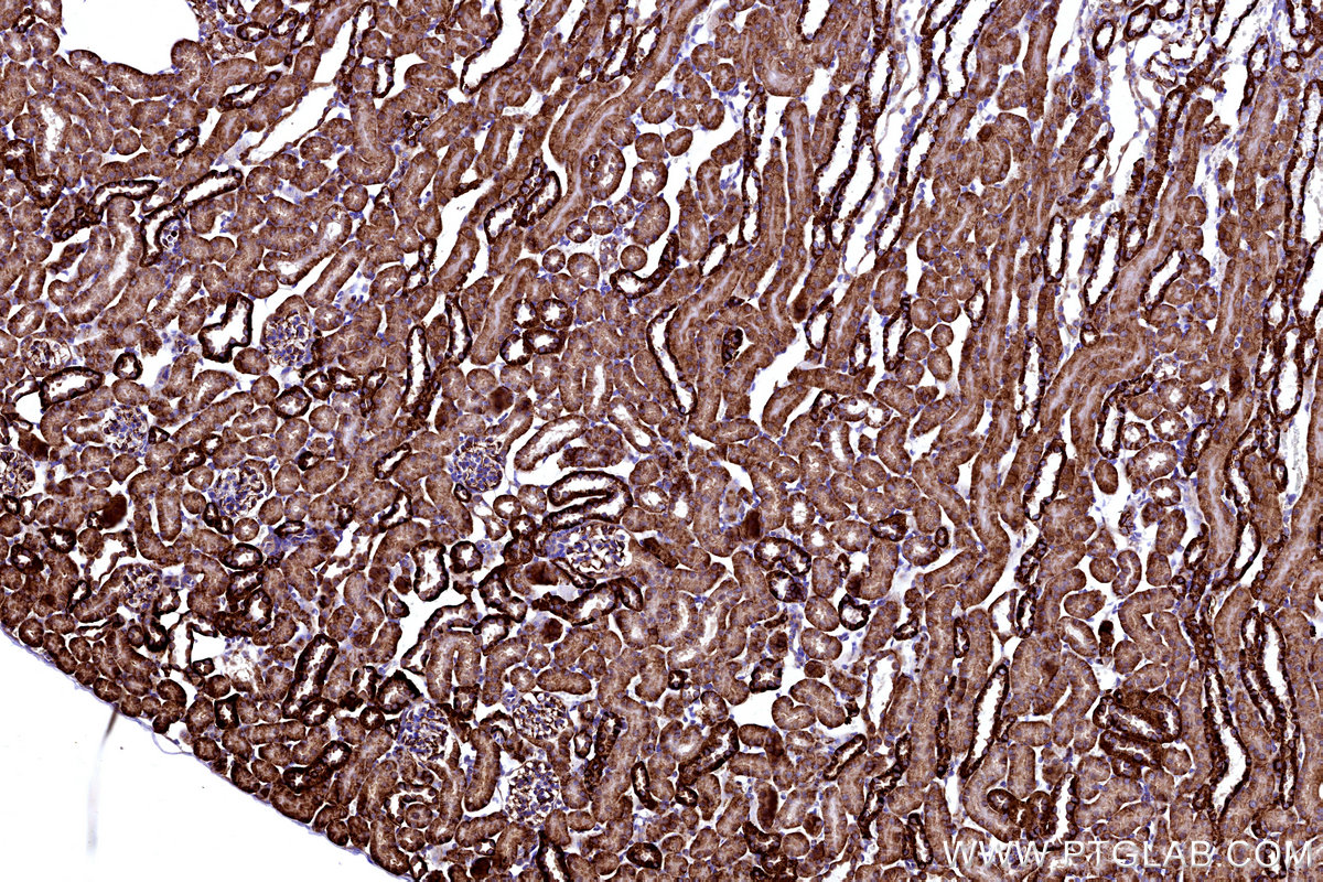 IHC staining of mouse kidney using 67828-1-Ig IHC staining of mouse kidney using 67828-1-Ig
