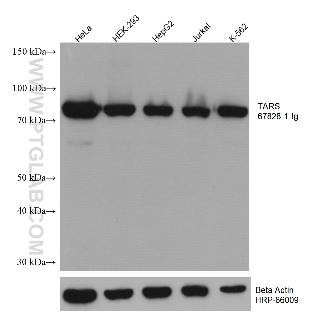 WB analysis using 67828-1-Ig